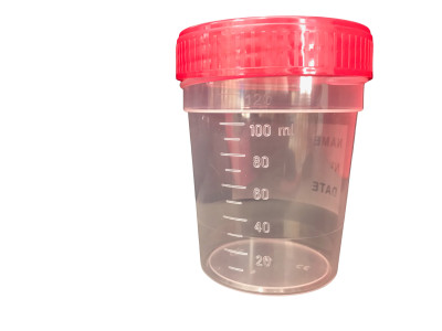 Vizeletgyűjtő pohár nem steril 120ml